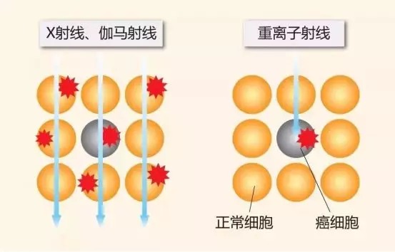 質(zhì)子重離子技術(shù)醫(yī)療險可以報銷嗎？